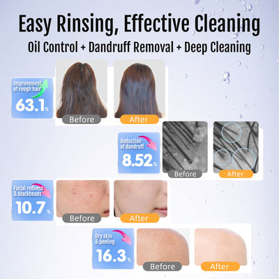 หัวฝักบัวพรีเมียมแบบฟองอากาศละเอียดพิเศษ | น้ำบริสุทธิ์พร้อมดีไซน์ทองเหลืองและสแตนเลส